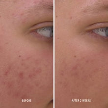 Load image into Gallery viewer, Clear Rescue Skin-Refining Serum