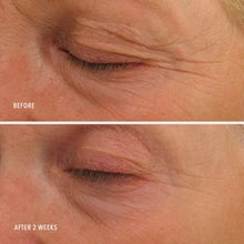 Load image into Gallery viewer, Eye Authority Eye Cream Dark Circles, Puffiness, Fine Lines