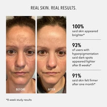 Load image into Gallery viewer, Firma-Bright 20% Vitamin C Booster