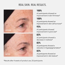 Load image into Gallery viewer, Liquid Resurfacing Solution Daily Leave-On Exfoliant