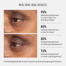 Load image into Gallery viewer, Retinol Eye Renewal Lifting & Firming Eye Balm