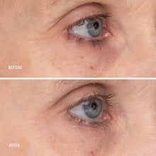 Load image into Gallery viewer, Retinol Eye Renewal Lifting & Firming Eye Balm