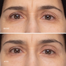 Load image into Gallery viewer, Retinol Eye Renewal Lifting & Firming Eye Balm
