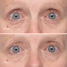Load image into Gallery viewer, Retinol Eye Renewal Lifting & Firming Eye Balm