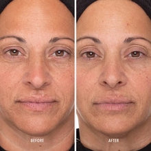 Load image into Gallery viewer, Retinol Routine Booster: 1% Retinol Solution