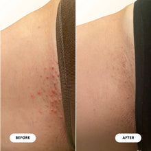 Load image into Gallery viewer, Bushbalm Ingrown Hair Oil | Vanilla Coconut