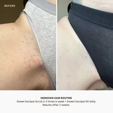 Load image into Gallery viewer, Bushbalm Ingrown Hair Oil - Sweet Escape

