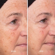 Load image into Gallery viewer, Liquid Resurfacing Solution Daily Leave-On Exfoliant
