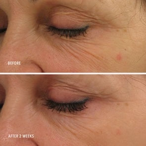 Power Serum Line Lifting Transformation