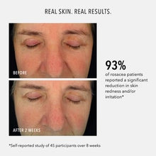 Load image into Gallery viewer, Soothing Serum: Redness Repair &amp; Relief
