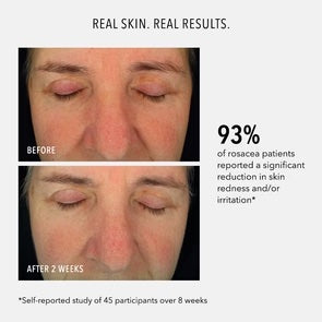 Soothing Serum: Redness Repair & Relief