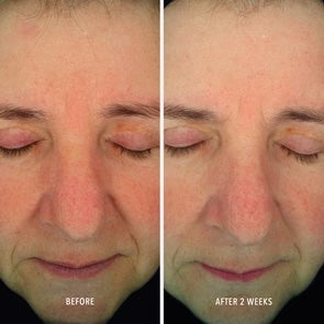 Soothing Serum: Redness Repair & Relief