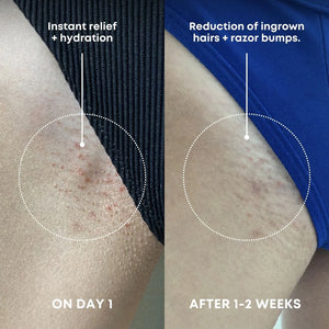 Bushbalm Ingrown Hair Exfoliating Scrub| Watermelon