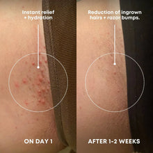 Load image into Gallery viewer, Bushbalm Ingrown Hair Exfoliating Scrub| Watermelon
