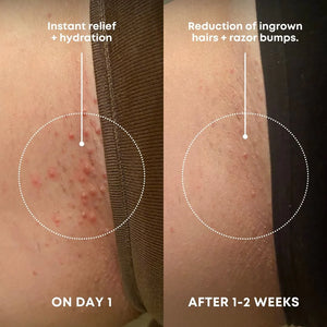 Bushbalm Ingrown Hair Exfoliating Scrub| Watermelon