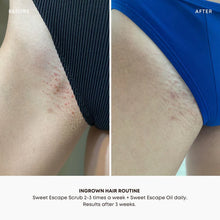 Load image into Gallery viewer, Bushbalm Ingrown Hair Oil - Sweet Escape
