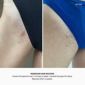 Bushbalm Ingrown Hair Oil - Sweet Escape