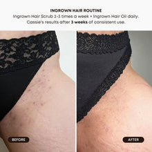 Load image into Gallery viewer, Bushbalm Ingrown Hair Oil - Watermelon Sugar
